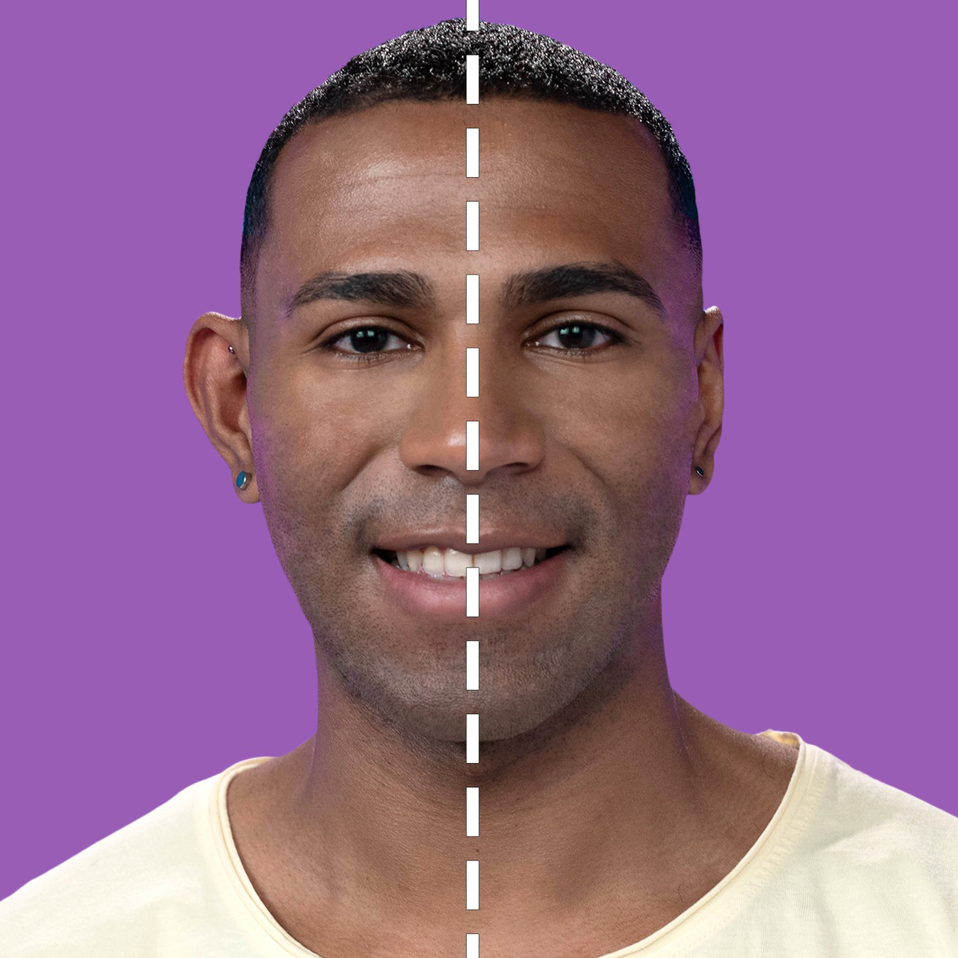 Corrector de Orejas