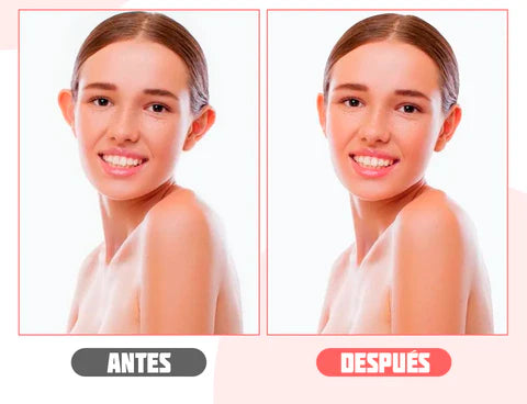 Corrector de Orejas